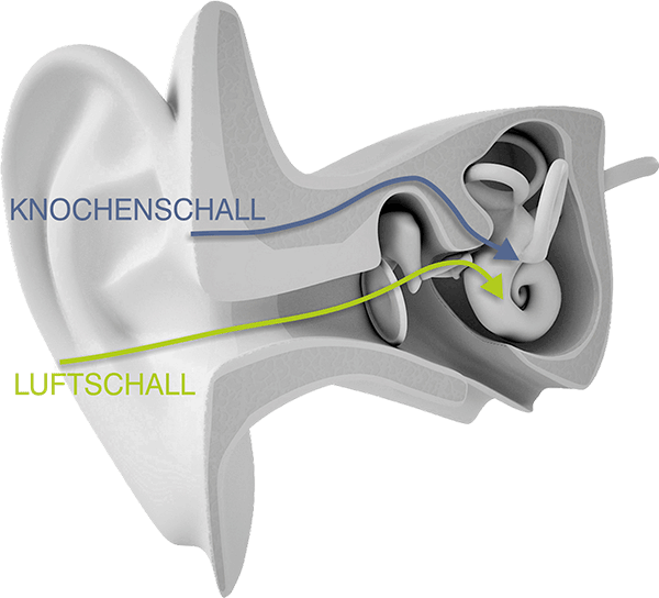 Knochenschallübertragung und Luftschallübertregung